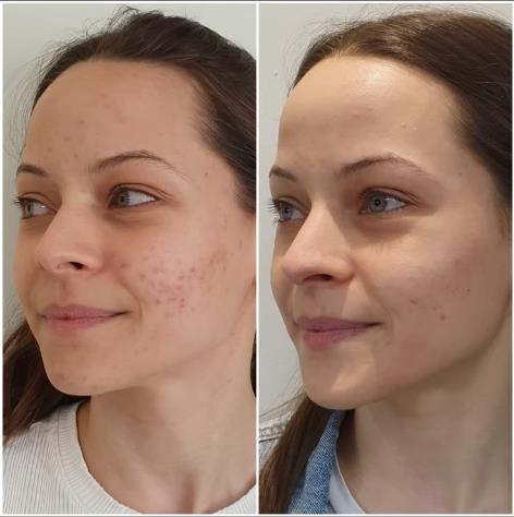 PEEL DIVA
